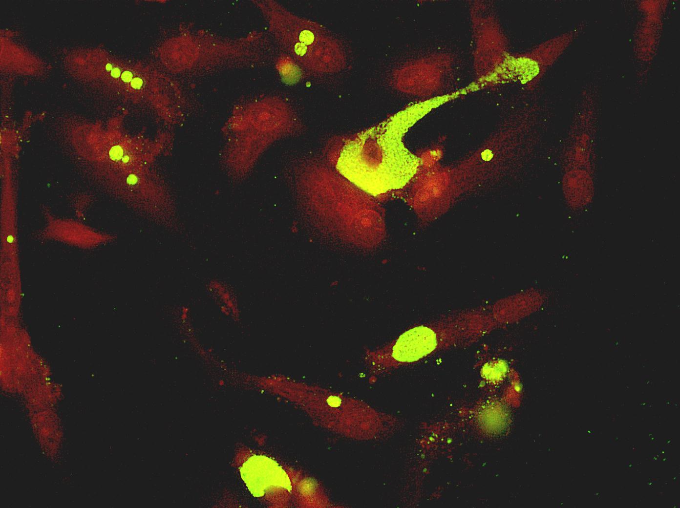 Download the full-sized image of Chlamydia pneumoniae in culture stained with FA (micrograph)